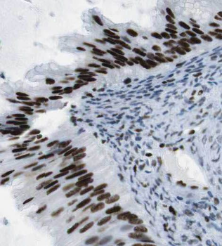 PAX8 Rabbit Polyclonal Antibody