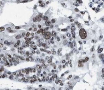 PAX8 Mouse Monoclonal Antibody