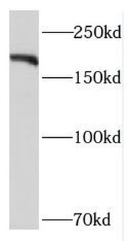 PBRM1 Rabbit Polyclonal Antibody