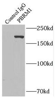 PBRM1 Rabbit Polyclonal Antibody