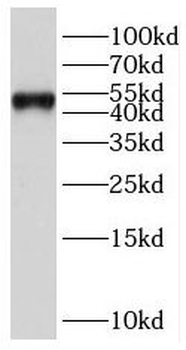 PBX3 Rabbit Polyclonal Antibody