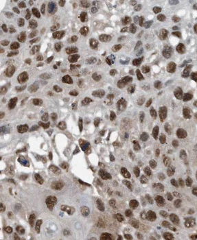 PBX3 Rabbit Polyclonal Antibody