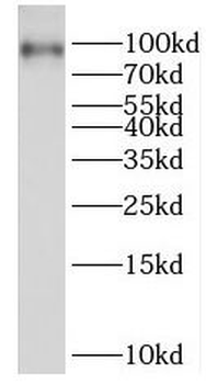 PBXIP1 Rabbit Polyclonal Antibody