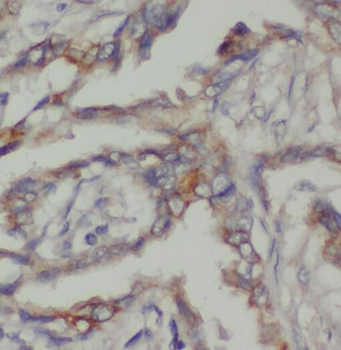 PBXIP1 Rabbit Polyclonal Antibody