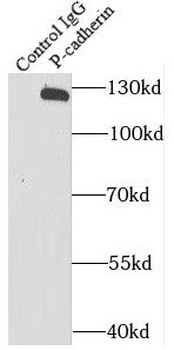 CDH3 Antibody