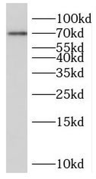 PCCA Rabbit Polyclonal Antibody
