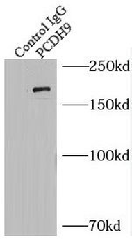 PCDH9 Rabbit Polyclonal Antibody