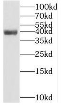 PCGF6 Rabbit Polyclonal Antibody