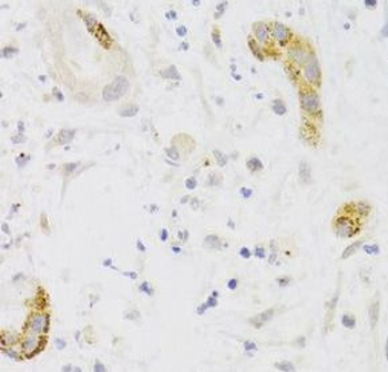 PCM1 Rabbit Polyclonal Antibody