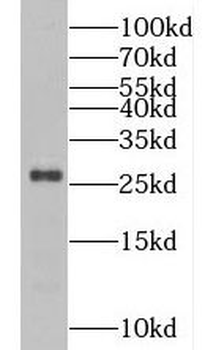 PCMT1 Rabbit Polyclonal Antibody