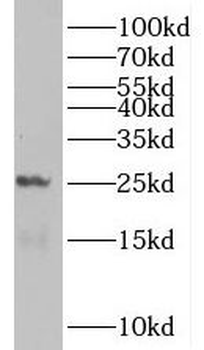 PCNP Rabbit Polyclonal Antibody