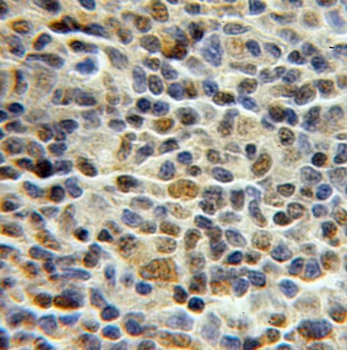 PCNP Rabbit Polyclonal Antibody
