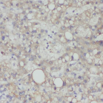 PCOLCE Rabbit Polyclonal Antibody