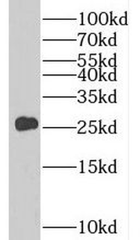 PCTP Rabbit Polyclonal Antibody