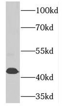 PCYT2 Rabbit Polyclonal Antibody