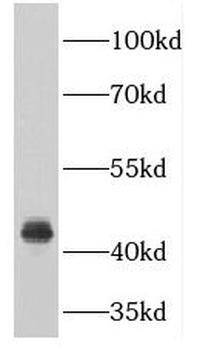 PDCD2 Rabbit Polyclonal Antibody