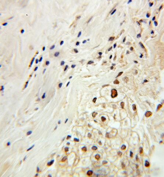 PDCD2 Rabbit Polyclonal Antibody