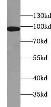 PDCD6IP Antibody