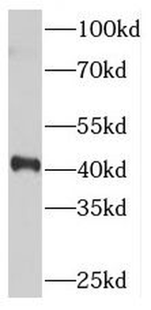 PDCL Rabbit Polyclonal Antibody