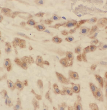 PDCL Rabbit Polyclonal Antibody