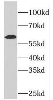 PDE1A Rabbit Polyclonal Antibody