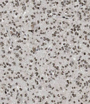 PDE1A Rabbit Polyclonal Antibody