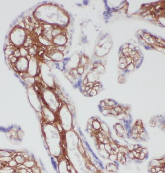 PDE4A Rabbit Polyclonal Antibody