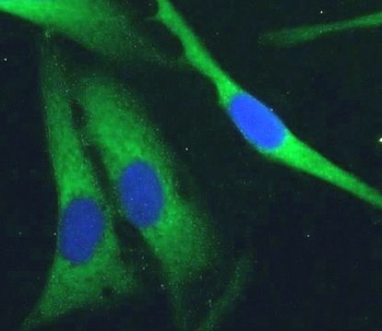 PDE5A Rabbit Polyclonal Antibody
