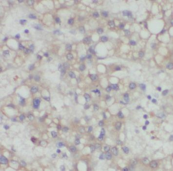 PDGFRL Antibody