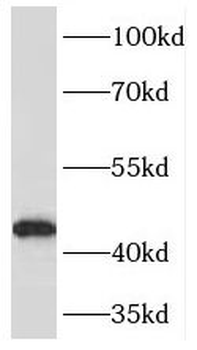 PDHA1 Rabbit Polyclonal Antibody
