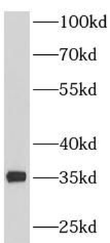 PDHB Rabbit Polyclonal Antibody