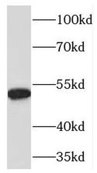 PDIA6 Rabbit Polyclonal Antibody