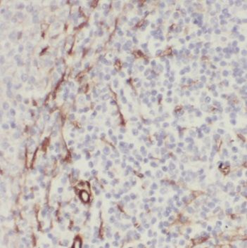 PDIA6 Rabbit Polyclonal Antibody