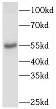 PDLIM7 Rabbit Polyclonal Antibody