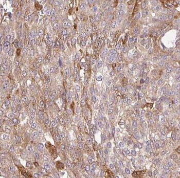 PDLIM7 Rabbit Polyclonal Antibody