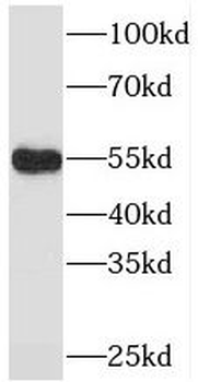 PDLIM7 Rabbit Polyclonal Antibody