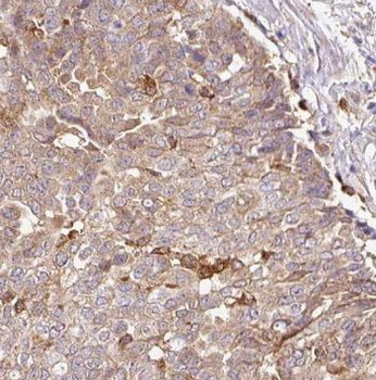 PDLIM7 Rabbit Polyclonal Antibody