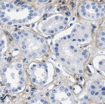 PDRG1 Rabbit Polyclonal Antibody