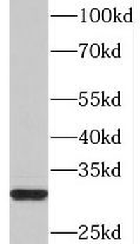 PDSS2 Rabbit Polyclonal Antibody