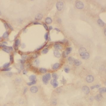 PDSS2 Rabbit Polyclonal Antibody