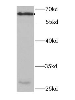 PDZK1 Rabbit Polyclonal Antibody
