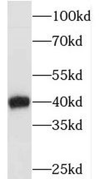 ECI2 Rabbit Polyclonal Antibody
