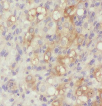 PELI2 Rabbit Polyclonal Antibody