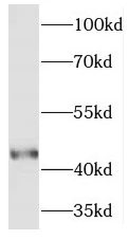 PELO Rabbit Polyclonal Antibody