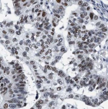 PELO Rabbit Polyclonal Antibody