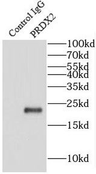 PRDX2 Antibody