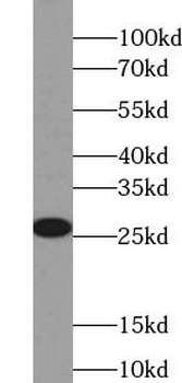 PRDX3 Rabbit Polyclonal Antibody