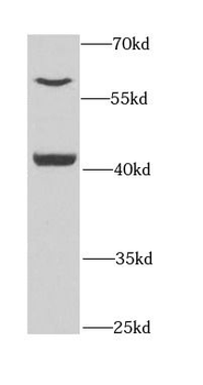 PEX14 Rabbit Polyclonal Antibody