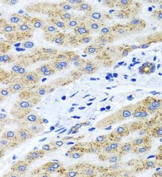 PEX14 Rabbit Polyclonal Antibody