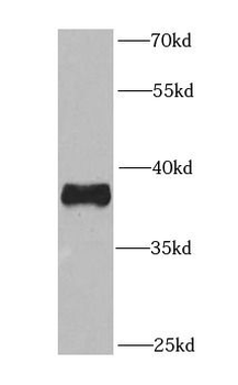PEX3 Rabbit Polyclonal Antibody